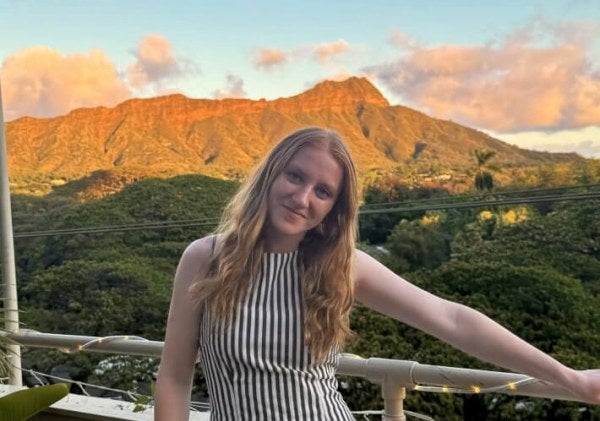 young woman, long red hair, outdoor balcony, mountains in background, vertical-striped dress